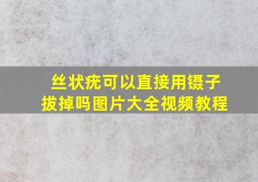 丝状疣可以直接用镊子拔掉吗图片大全视频教程