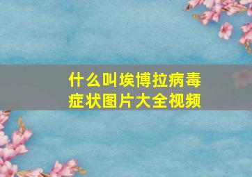 什么叫埃博拉病毒症状图片大全视频