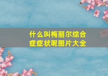 什么叫梅丽尔综合症症状呢图片大全