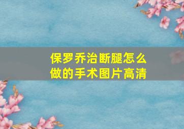 保罗乔治断腿怎么做的手术图片高清