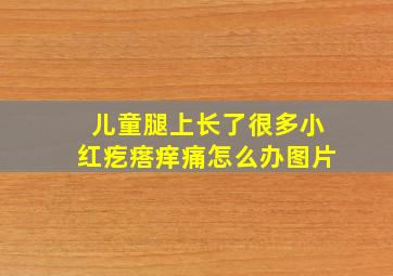 儿童腿上长了很多小红疙瘩痒痛怎么办图片