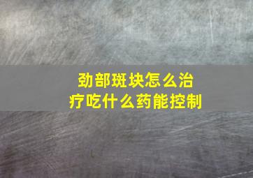 劲部斑块怎么治疗吃什么药能控制