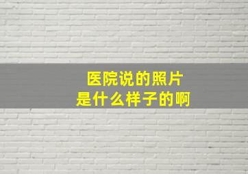 医院说的照片是什么样子的啊