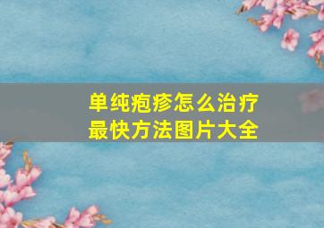 单纯疱疹怎么治疗最快方法图片大全