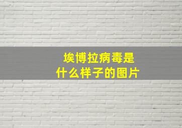 埃博拉病毒是什么样子的图片