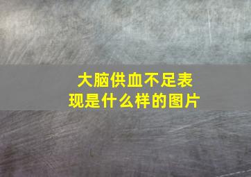 大脑供血不足表现是什么样的图片