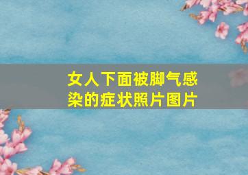 女人下面被脚气感染的症状照片图片