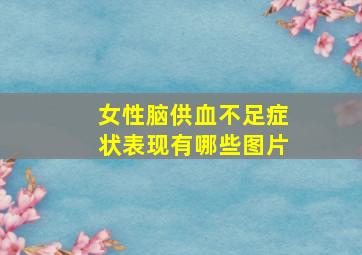 女性脑供血不足症状表现有哪些图片