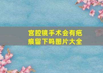 宫腔镜手术会有疤痕留下吗图片大全