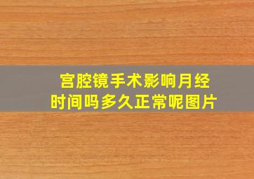 宫腔镜手术影响月经时间吗多久正常呢图片