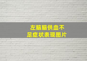 左脑脑供血不足症状表现图片