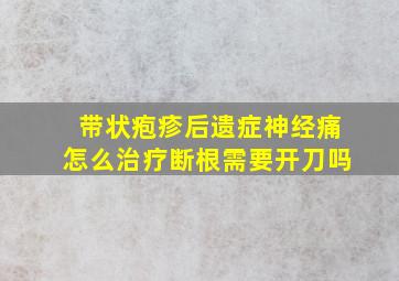 带状疱疹后遗症神经痛怎么治疗断根需要开刀吗