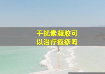 干扰素凝胶可以治疗疱疹吗