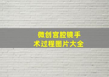 微创宫腔镜手术过程图片大全