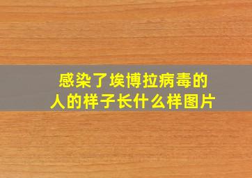 感染了埃博拉病毒的人的样子长什么样图片