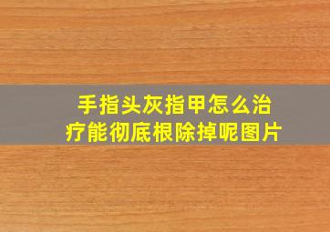 手指头灰指甲怎么治疗能彻底根除掉呢图片