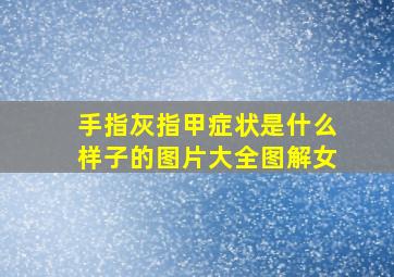 手指灰指甲症状是什么样子的图片大全图解女