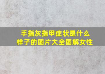 手指灰指甲症状是什么样子的图片大全图解女性