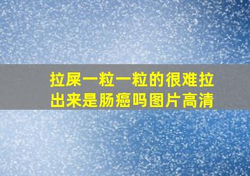 拉屎一粒一粒的很难拉出来是肠癌吗图片高清