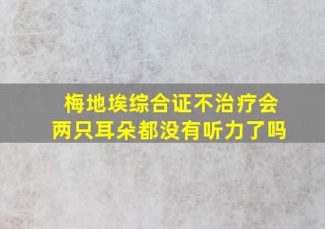 梅地埃综合证不治疗会两只耳朵都没有听力了吗