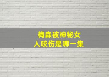 梅森被神秘女人咬伤是哪一集