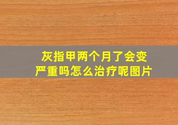 灰指甲两个月了会变严重吗怎么治疗呢图片