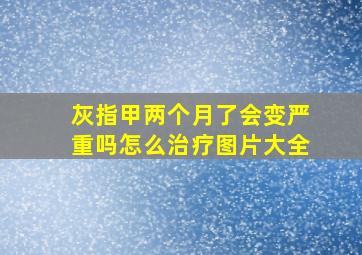 灰指甲两个月了会变严重吗怎么治疗图片大全