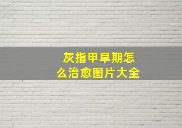 灰指甲早期怎么治愈图片大全