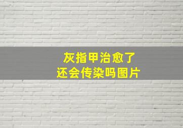 灰指甲治愈了还会传染吗图片