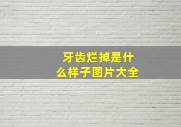 牙齿烂掉是什么样子图片大全