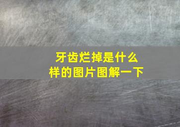 牙齿烂掉是什么样的图片图解一下