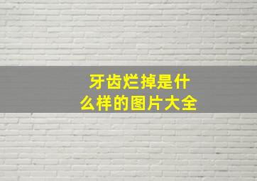 牙齿烂掉是什么样的图片大全