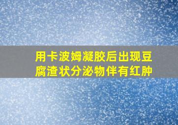 用卡波姆凝胶后出现豆腐渣状分泌物伴有红肿