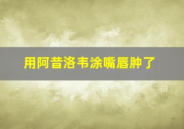 用阿昔洛韦涂嘴唇肿了