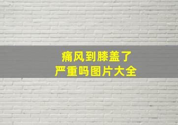 痛风到膝盖了严重吗图片大全