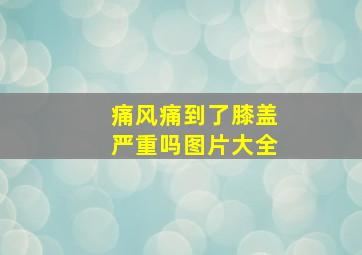 痛风痛到了膝盖严重吗图片大全