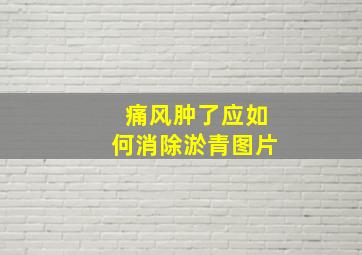 痛风肿了应如何消除淤青图片