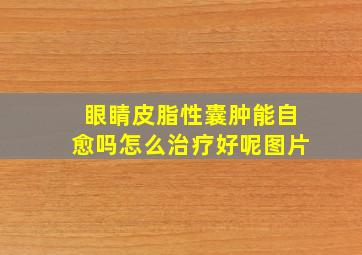 眼睛皮脂性囊肿能自愈吗怎么治疗好呢图片