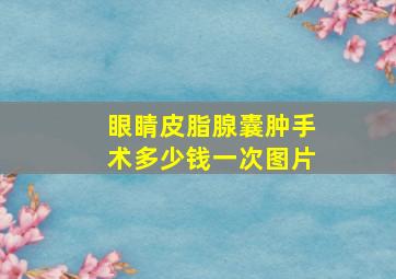 眼睛皮脂腺囊肿手术多少钱一次图片