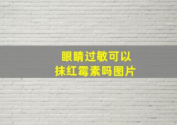 眼睛过敏可以抹红霉素吗图片