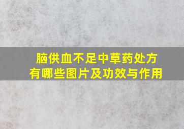 脑供血不足中草药处方有哪些图片及功效与作用