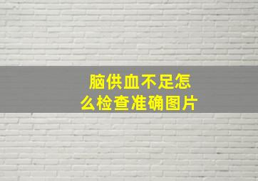 脑供血不足怎么检查准确图片