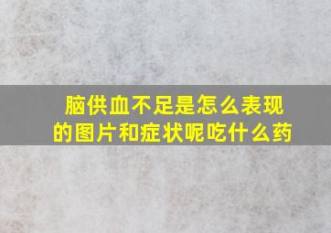 脑供血不足是怎么表现的图片和症状呢吃什么药