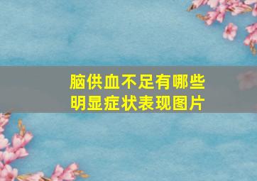 脑供血不足有哪些明显症状表现图片