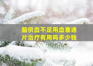 脑供血不足用血塞通片治疗有用吗多少钱