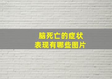 脑死亡的症状表现有哪些图片