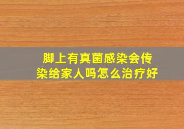 脚上有真菌感染会传染给家人吗怎么治疗好