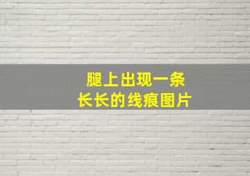 腿上出现一条长长的线痕图片