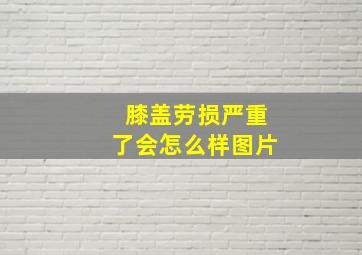 膝盖劳损严重了会怎么样图片