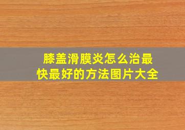 膝盖滑膜炎怎么治最快最好的方法图片大全